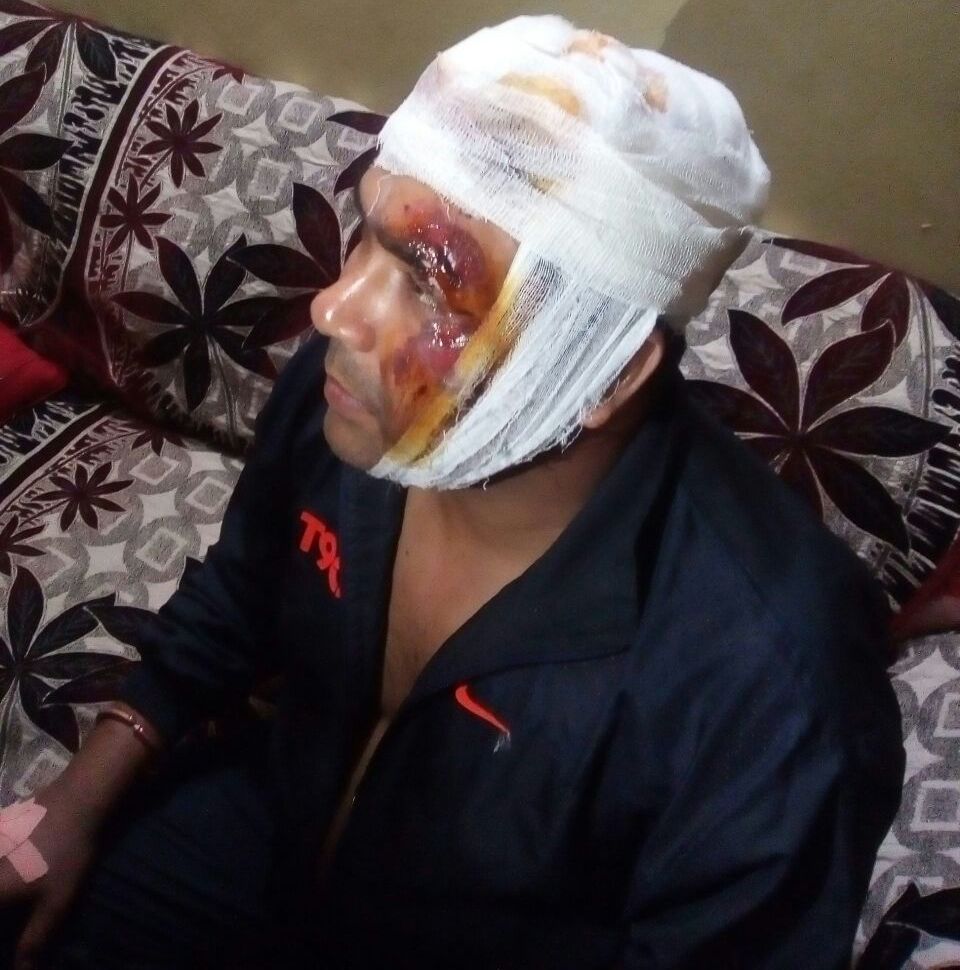 RPF Sushil Pathak attacked Titilagarh